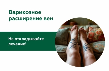 Жизнь с варикозом и без. Почему пациенты не начинают лечение?
